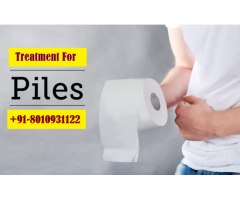 +91-8010931122|best Piles specialist doctor in Dwarka Expressway Gurgaon