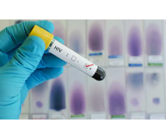 Antibodies test for HIV 1 in Rajiv Chowk [+91-8010977000]