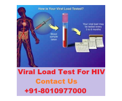 [+91-8010977000] Viral load test for HIV in Safdarjung Enclave