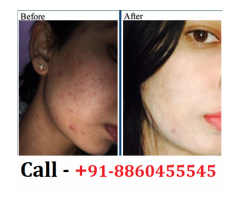 Best Skin Specialist Clinic in Aunrihar || 8860455545