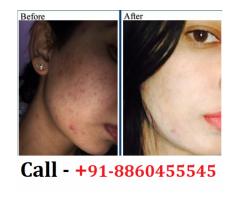 PH : 8860455545 : best dermatologist in Ramnath Deoria