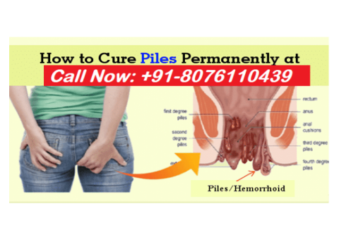 8010931122 - Best treatment for piles in Bichhor