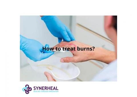 How to treat burns?