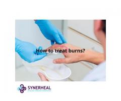 How to treat burns?