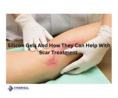 Silicon Gels And How They Can Help With Scar Treatment