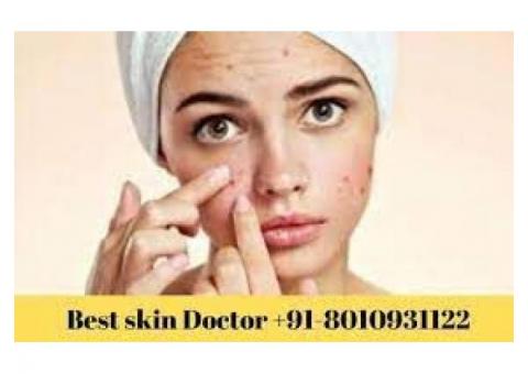 skin problem treatment in delhi 8010931122