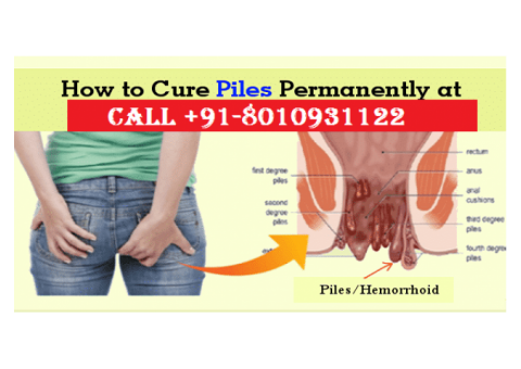 Piles treatment in West Delhi without surgery