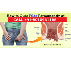 Piles treatment in West Delhi without surgery