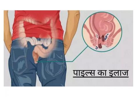 Pilonidal Sinus Treatment in Vasant Vihar 8010931122