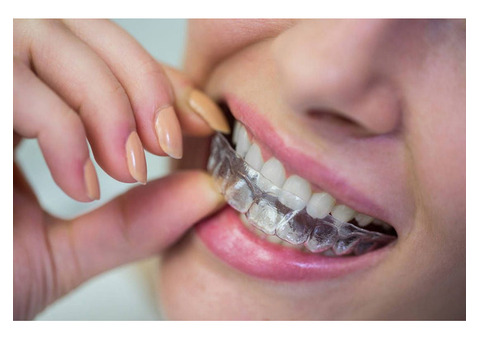 BENEFITS OF BRACES BEYOND AESTHETICS