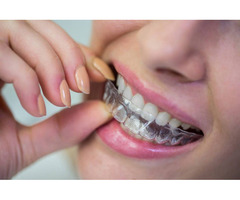 BENEFITS OF BRACES BEYOND AESTHETICS