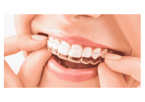 MAINTAINING YOUR SMILE AFTER INVISALIGN TREATMENT