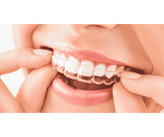 MAINTAINING YOUR SMILE AFTER INVISALIGN TREATMENT