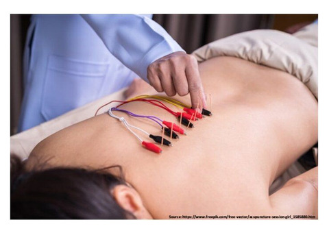 From Traditional to Tech: How Electroacupuncture is Transforming Wellness in Mumbai!!