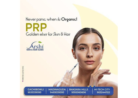 Choosing the Right PRP Specialist in Hyderabad