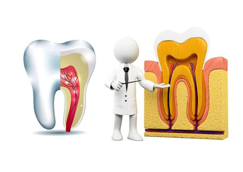 UNDERSTANDING THE ROOT CANAL PROCEDURE: WHAT PATIENTS IN THANE NEED TO KNOW