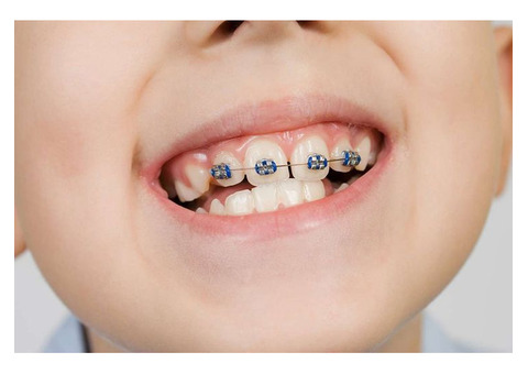 WHEN SHOULD KIDS IN THANE GET THEIR FIRST ORTHODONTIC CHECK-UP?