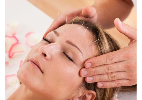 Acupuncture Therapy in Mumbai: Why It’s a Go-To for Natural Healing!!