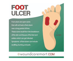 No More Worries About Foot Ulcer! | Woundcaremart